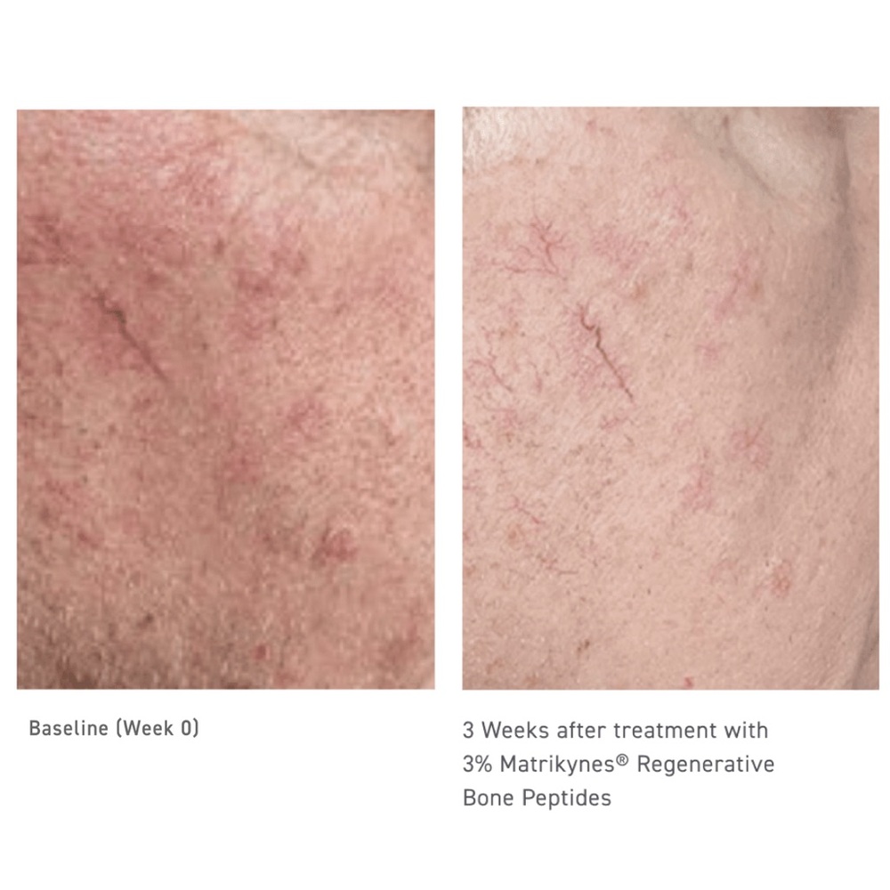 NIB: Sweet Chemistry - Elasticity Reinforcing lipid Cream 1.7 OZ $149 - Picture 2 of 13
